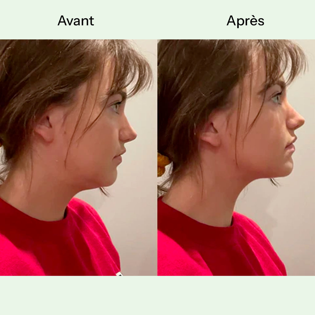 Sculpt V-Mask™