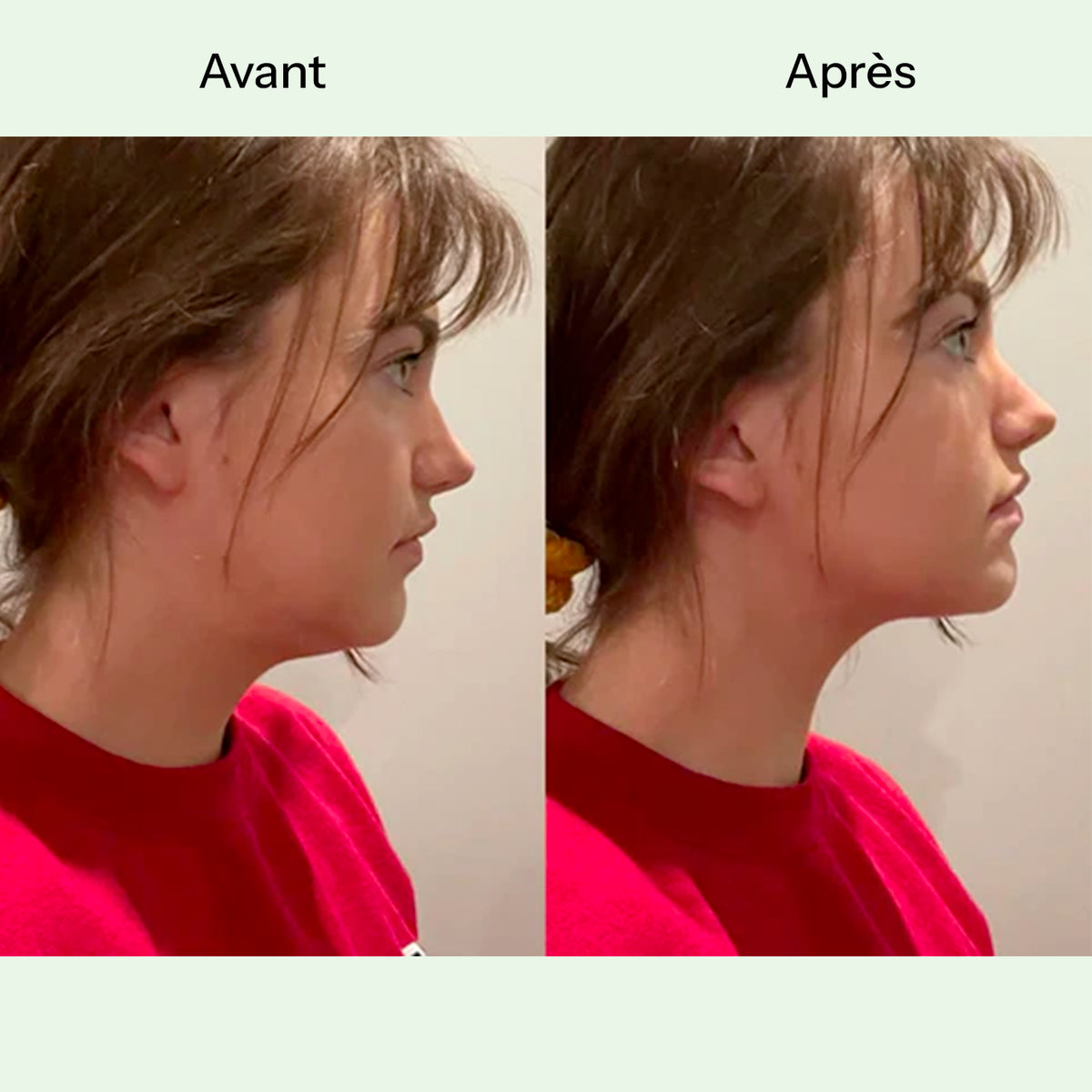 Sculpt V-Mask™