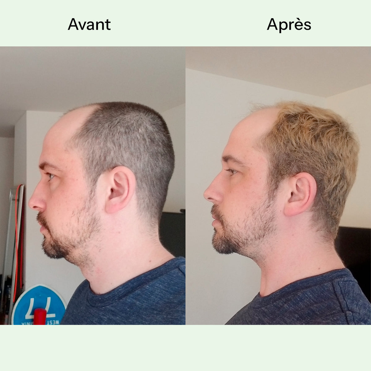 Sculpt V-Mask™